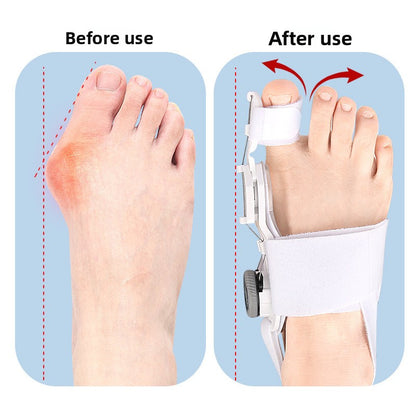 ToeFix Bunion Corrector